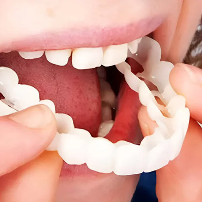 CARILLAS DENTALES SNAPON SMILE